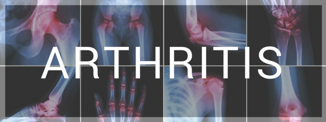 ARTHRITIS